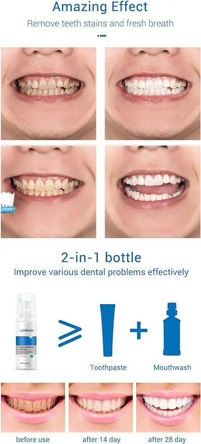 Teeth Whitening Mousse Safwa Shop
